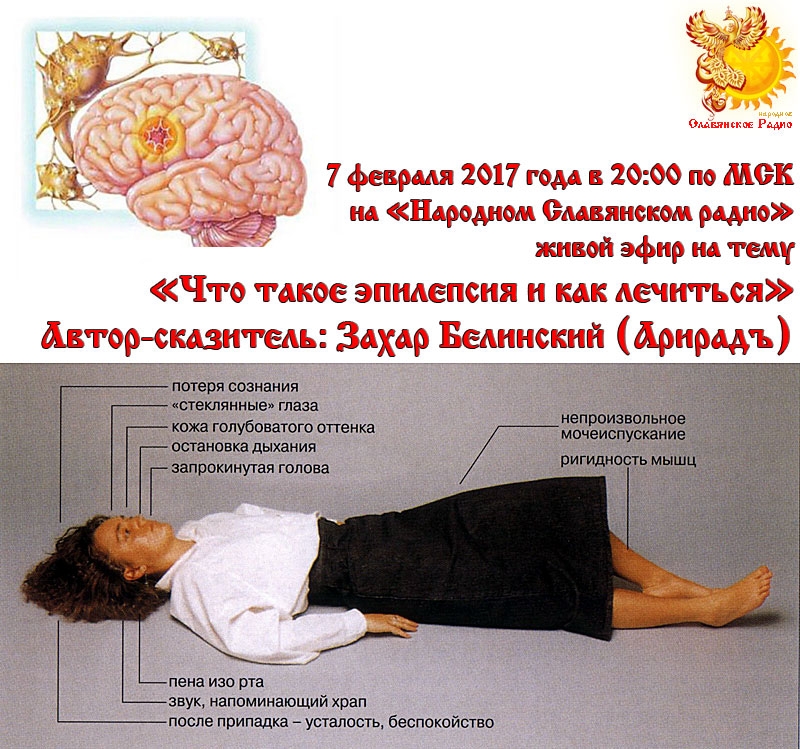 Что такое эпилепсия и как лечиться