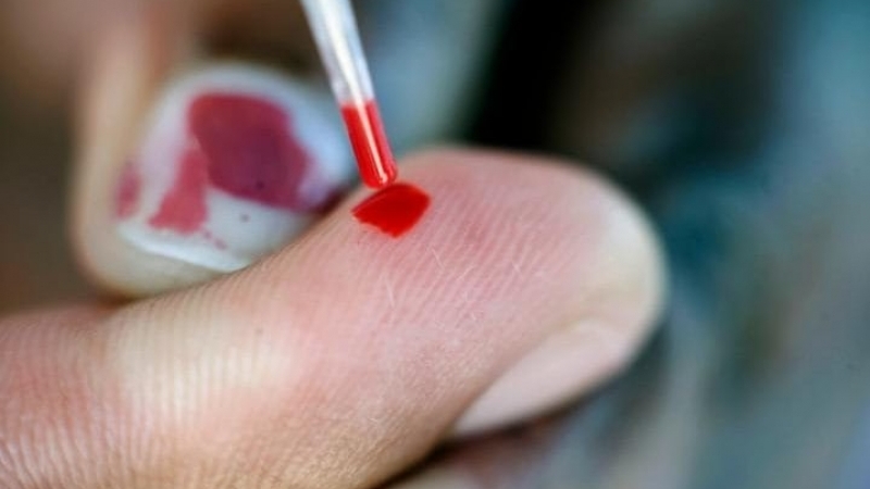 Анализ крови для обнаружения рецидива рака лёгких