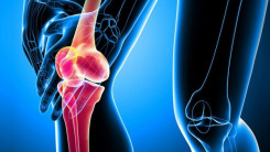 Лечение артроза перекисью водорода: теория профессора Неумывакина